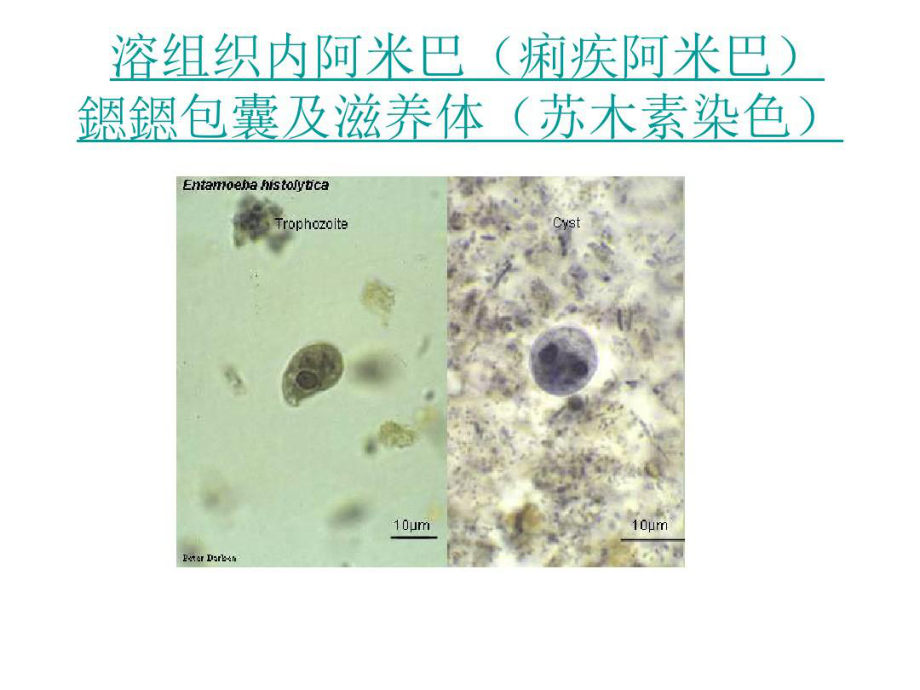 最全常见寄生虫图谱100张课件.ppt_第2页