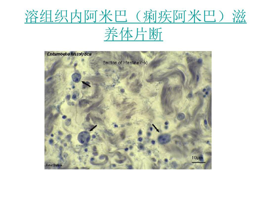 最全常见寄生虫图谱100张课件.ppt_第3页