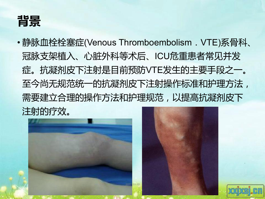 抗凝剂皮下注射的临床实践课件.ppt_第3页