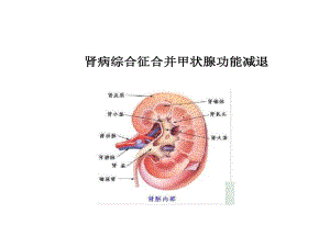 急性肾损伤与急性肾衰竭诊断治疗共53张课件.ppt