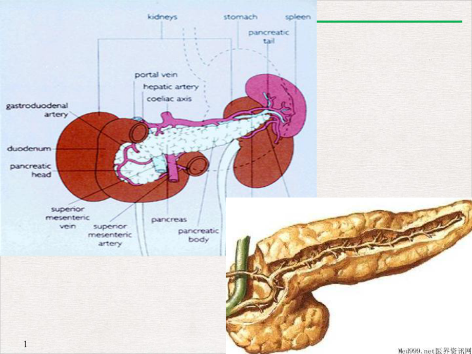 急性胰腺炎推荐课件.ppt_第2页