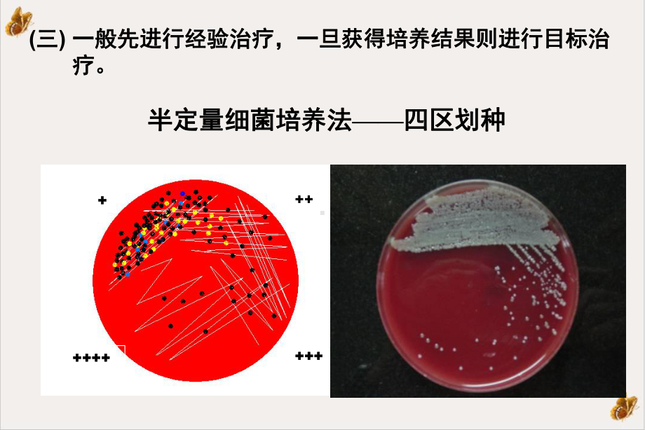 抗生素临床合理应用参考课件.ppt_第2页