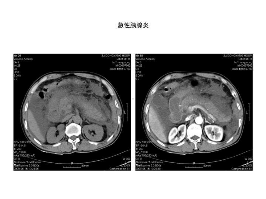 执业医师考讲义试放射课件.ppt_第3页