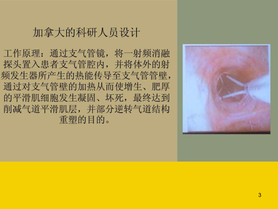 支气管热成形术课件.ppt_第3页