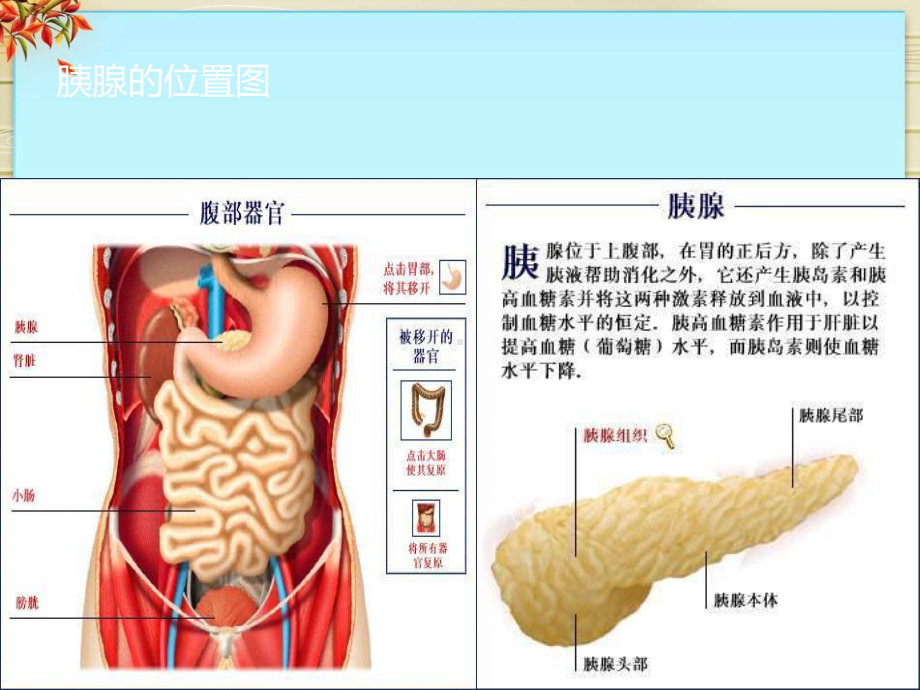 急性胰腺炎的护理讲课课件.pptx_第2页