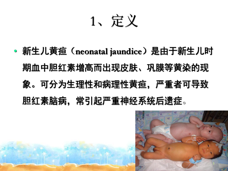 新生儿高胆红素血症浅析课件.ppt_第3页