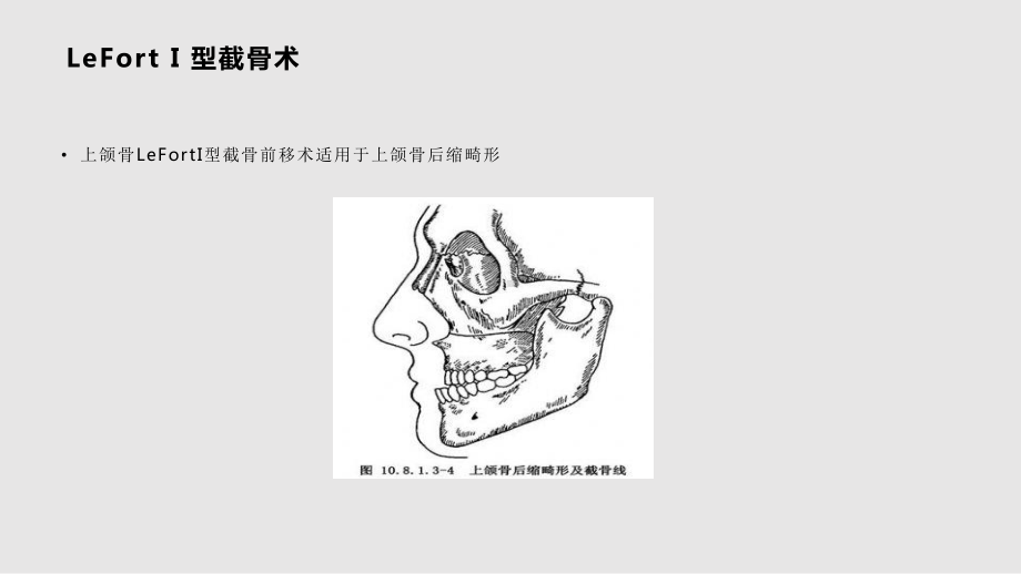 教学正颌患者的护理课件.pptx_第2页