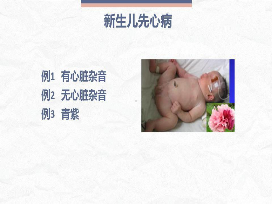 新生儿先天性心脏病病例讨论共40张课件.ppt_第2页