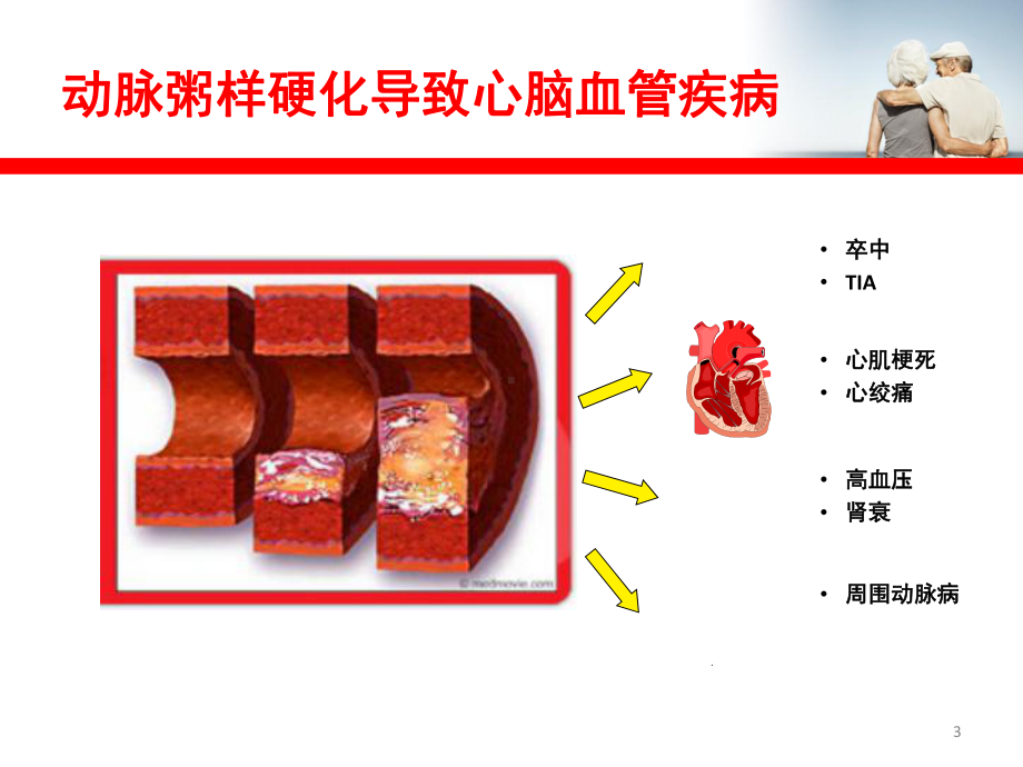 控制血脂与防范心脑血管疾病共32张课件.ppt_第3页