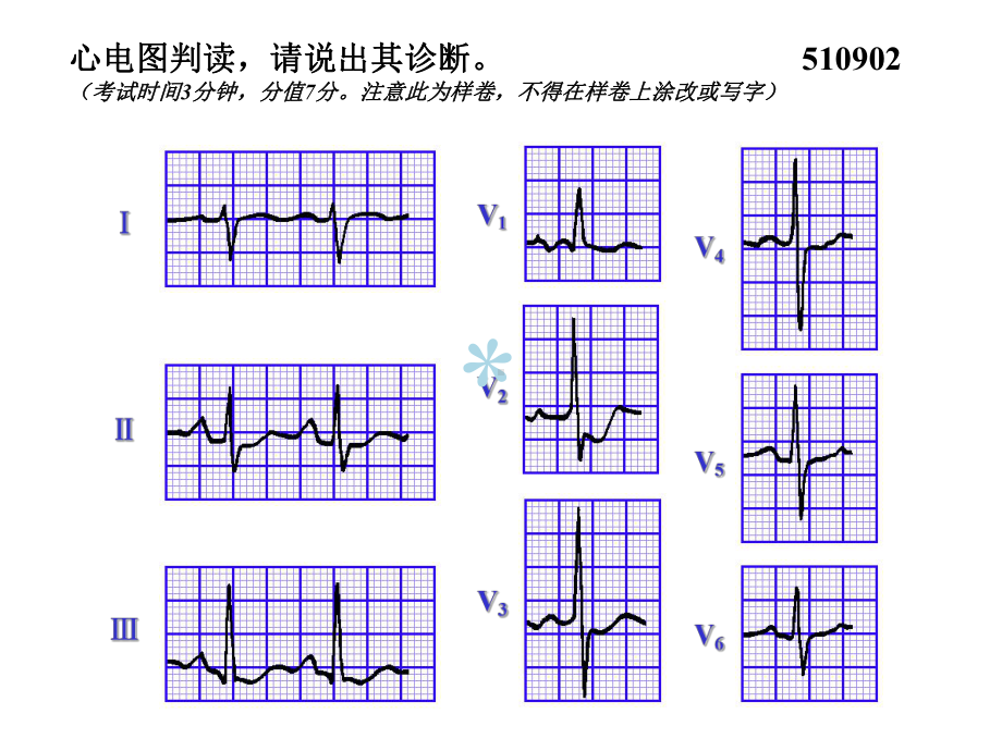 执业医师实践技能考核心电图试题集课件.ppt_第2页