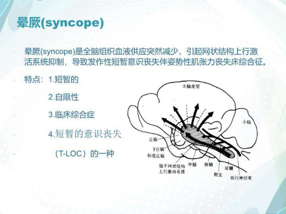 晕厥诊治课件.ppt_第3页