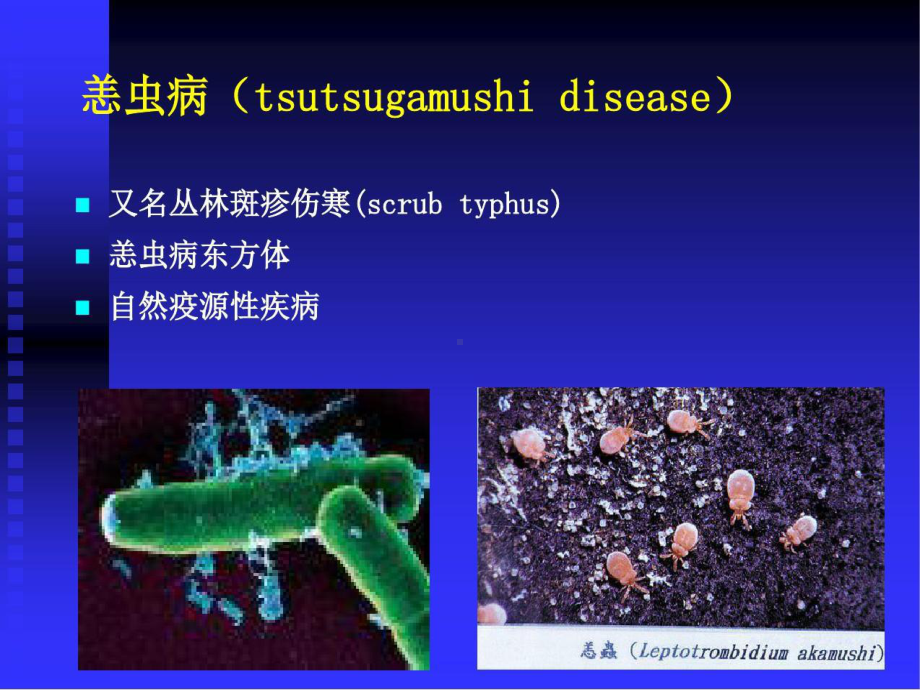 恙虫病诊断和治疗40张课件.ppt_第2页