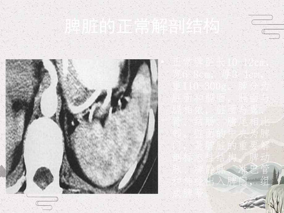 脾脏的正常解剖与影像诊断课件.pptx_第3页