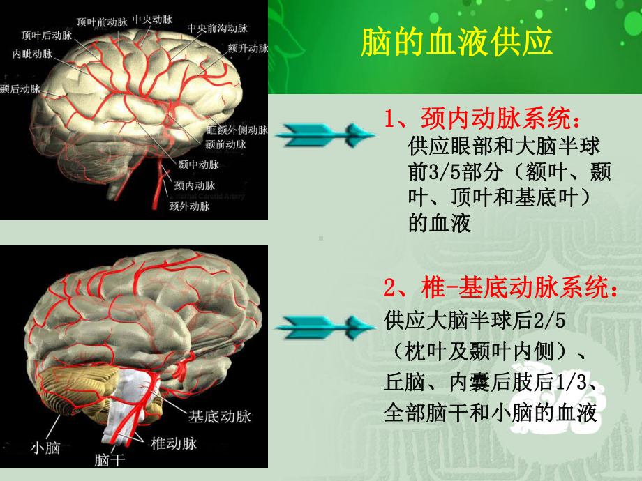 脑梗死护理课件.ppt_第3页