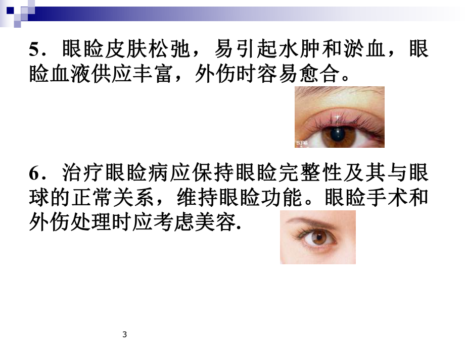 眼睑病病人的护理课件.ppt_第3页