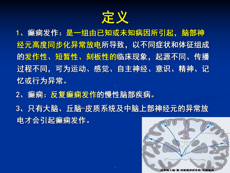 癫痫神经病学医学课件.ppt_第2页