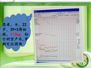 浅谈肥胖患者的麻醉处理课件.pptx