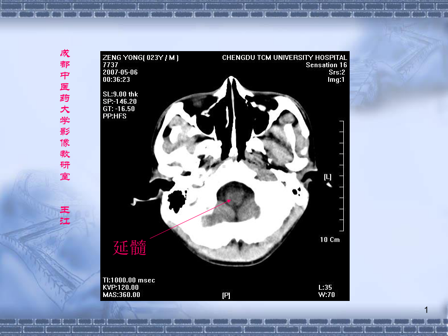 颅脑CT影像学-课件.ppt_第1页