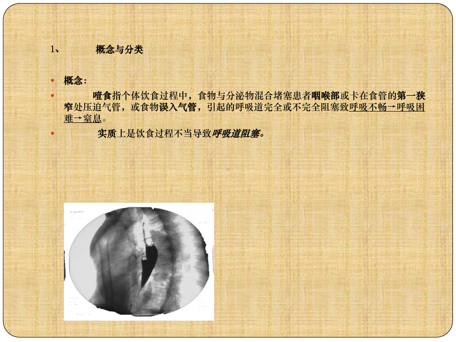 精神病患者噎食窒息急救及防范课件.ppt_第3页