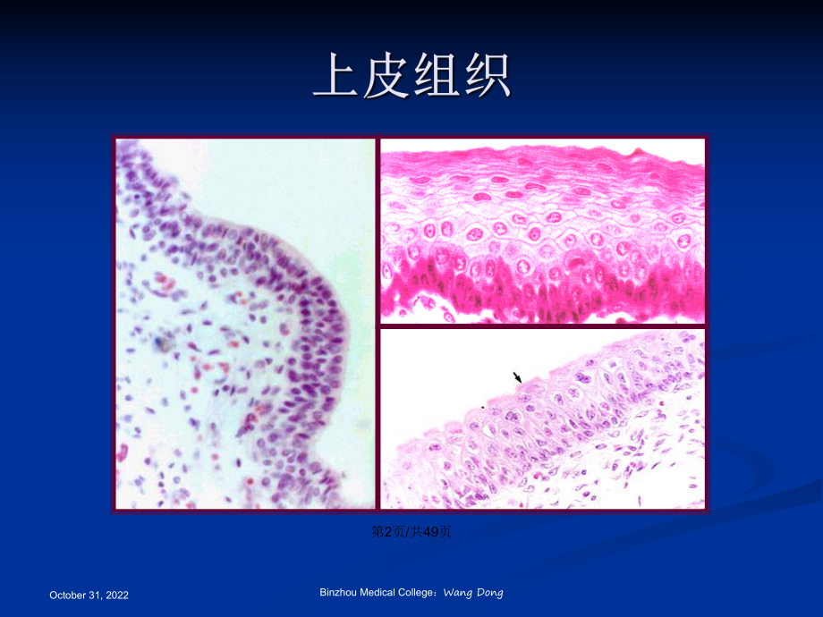 结缔组织滨州医学院组织学与胚胎学教案课件.pptx_第3页