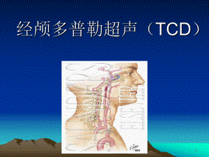 经颅多普勒超声(TCD)医学课件.ppt