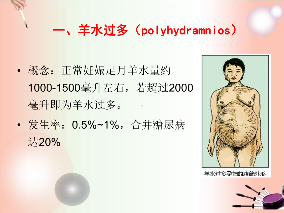 羊水异常过期妊娠课件.ppt_第3页