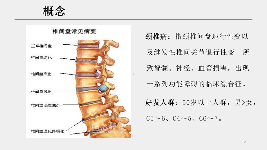 颈椎病的护理查房课件.pptx_第2页