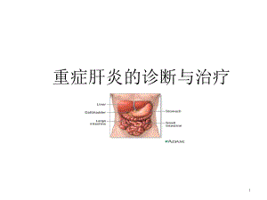 重症肝炎的诊断-课件.ppt