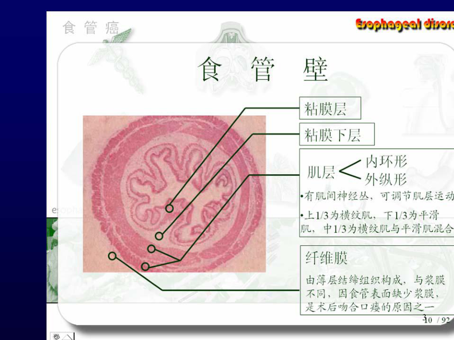 食管癌的诊断课件.ppt_第3页