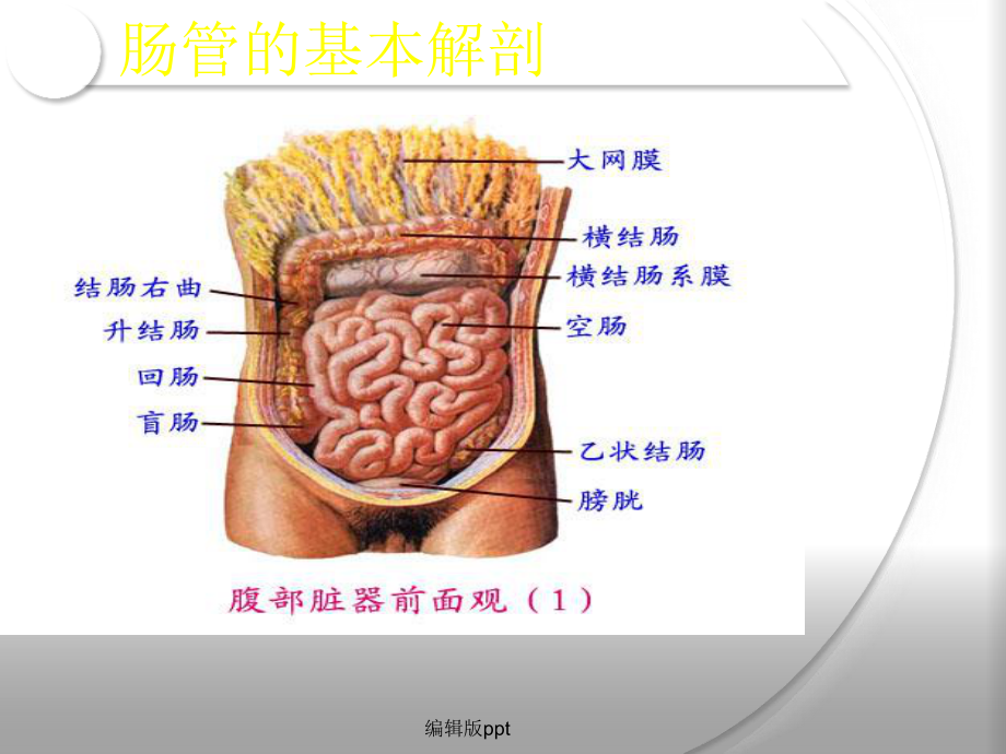 肠梗阻查房课件.ppt_第3页