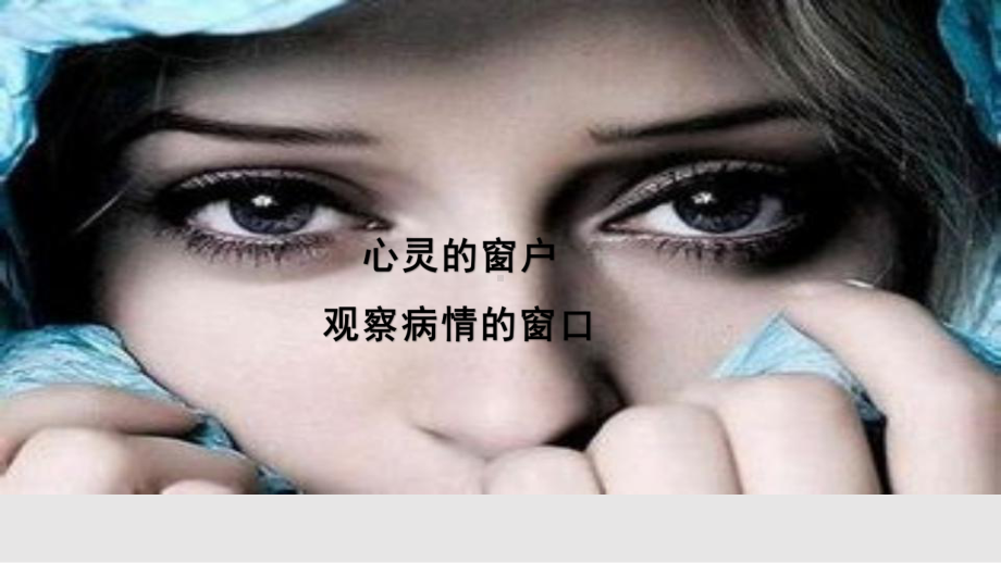 眼科会诊课件.pptx_第2页