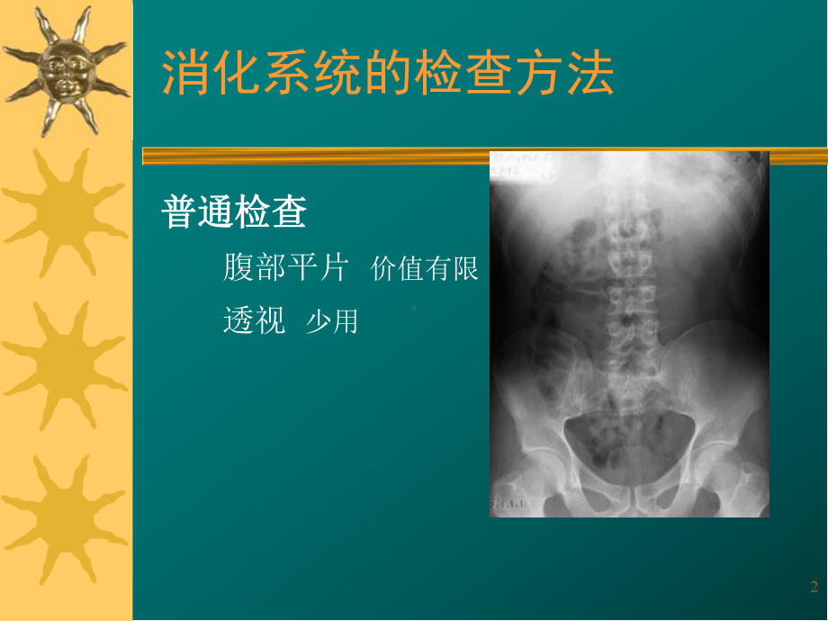 消化系统影像诊断医学影像医学课件.ppt_第2页