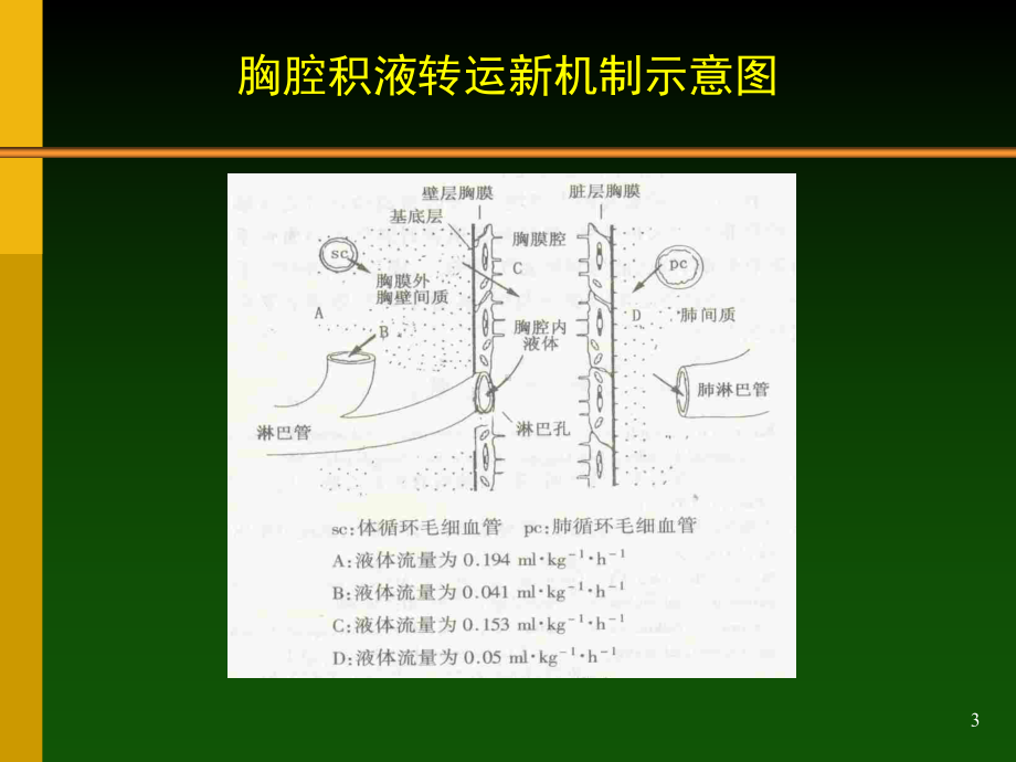 胸腔积液鉴别诊断课件.ppt_第3页