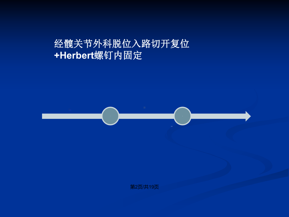 股骨头骨折经髋关节外科脱位入路切开复位内固定术教案课件.pptx_第3页