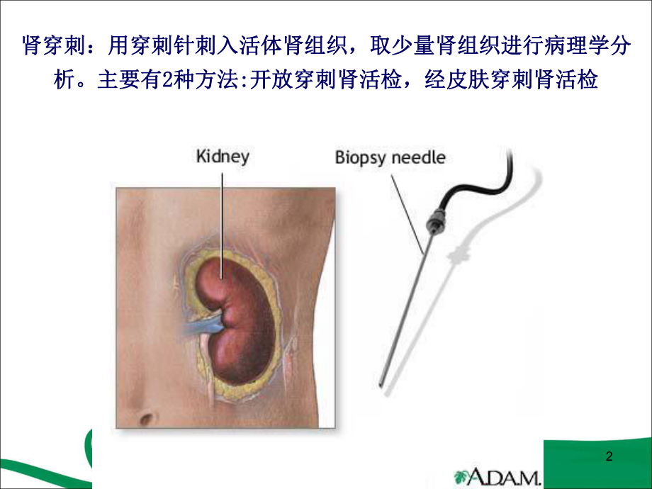 肾穿刺活检版(课堂)课件.ppt_第2页