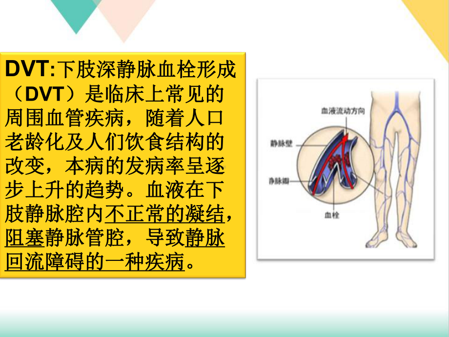 预防下肢深静脉血栓的护理课件.ppt_第2页