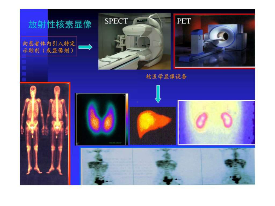 核医学显像原理-课件.ppt_第3页