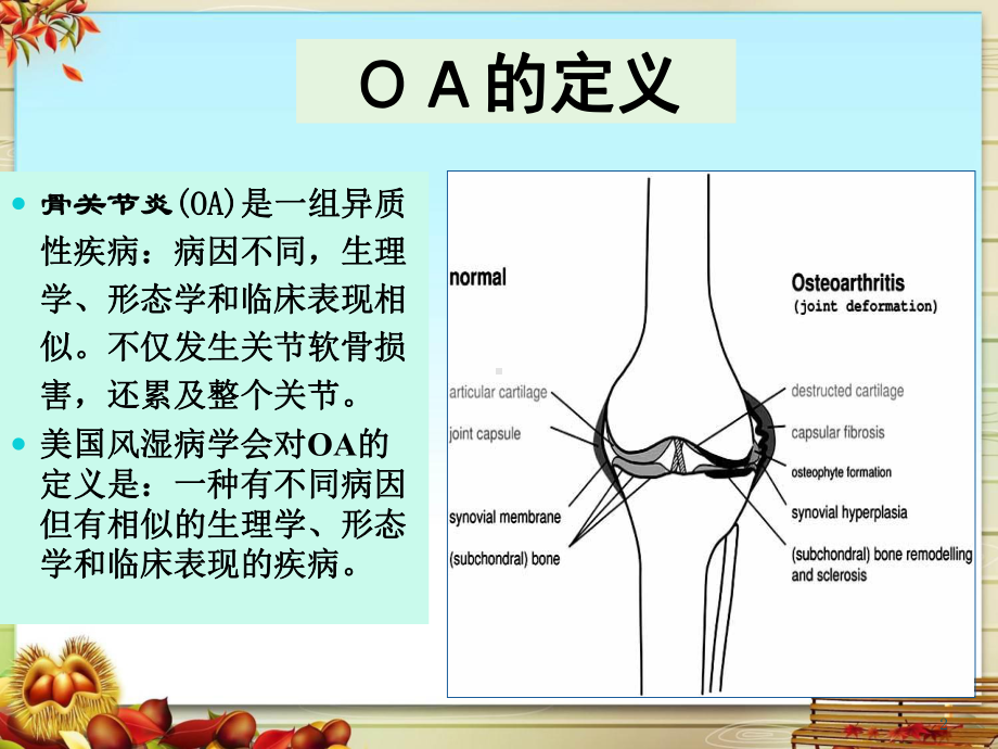 骨关节炎课件.pptx_第2页