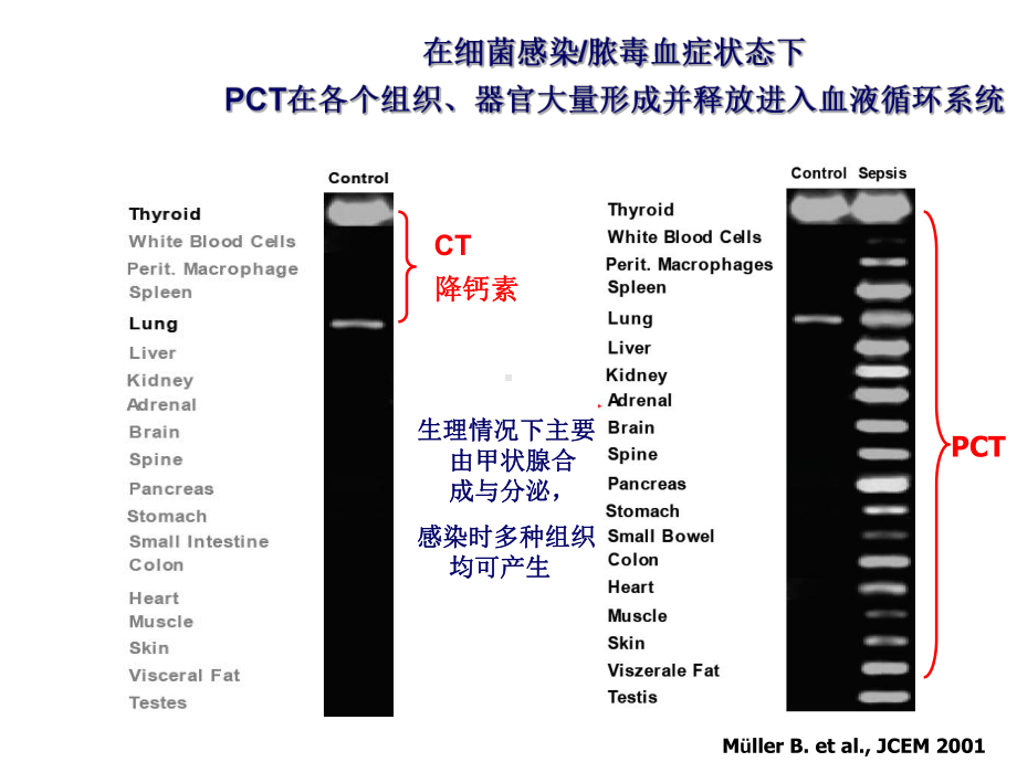 炎性指标及临床应用课件.ppt_第3页