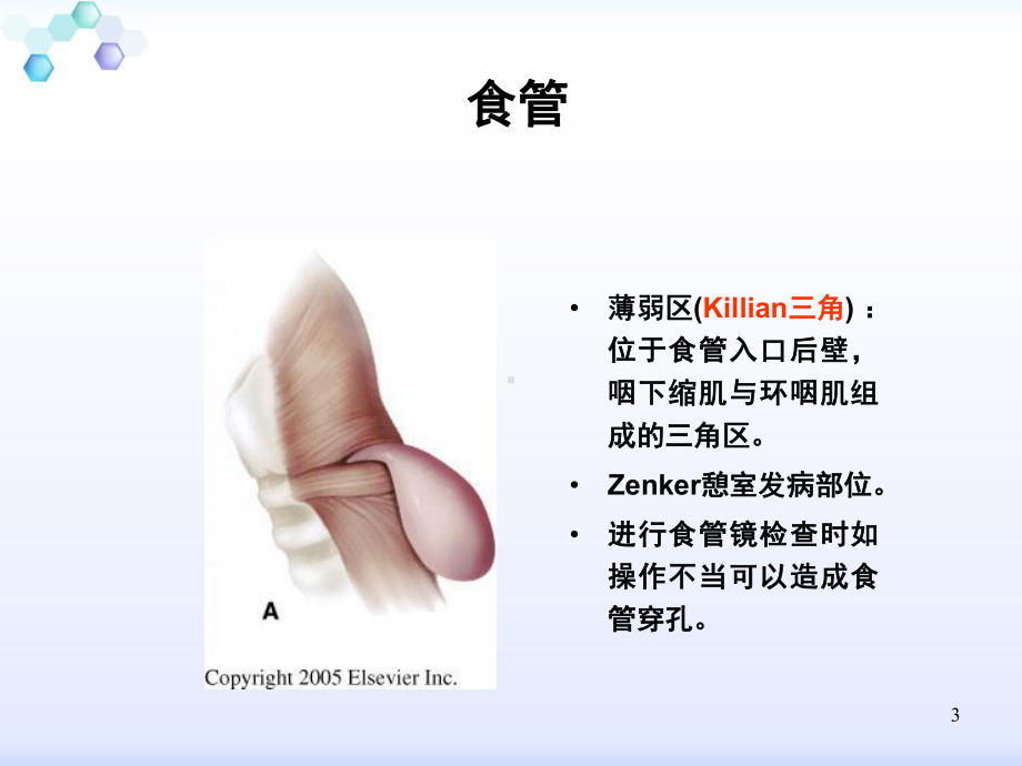 食管异物护理课件.ppt_第3页