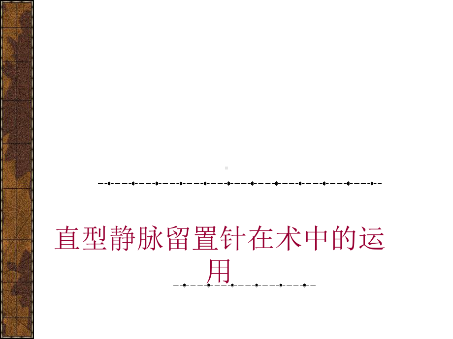 直型静脉留置针课件.ppt_第1页