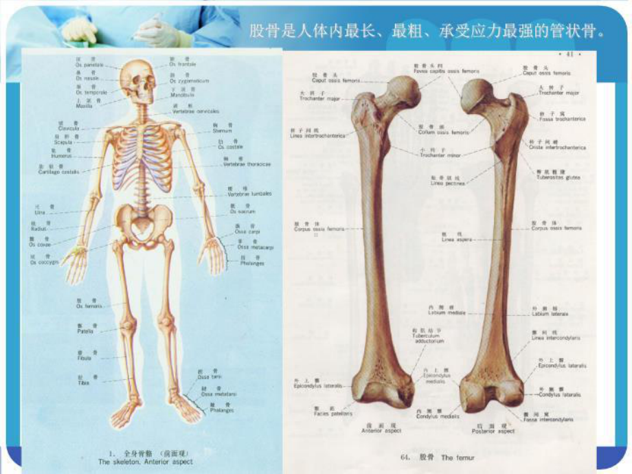 股骨干骨折病人的护理-课件.ppt_第2页