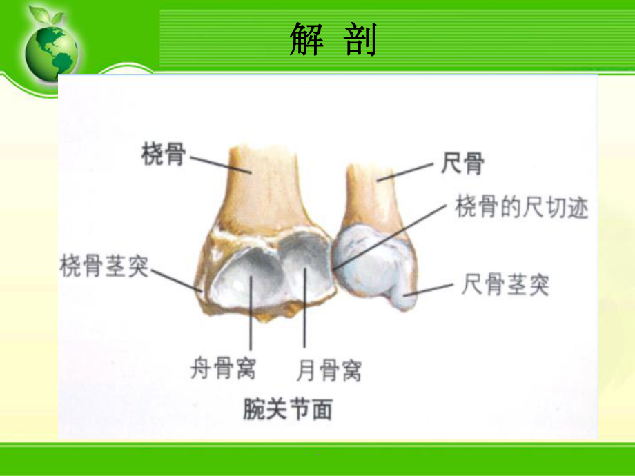 腕关节骨折课件.ppt_第3页