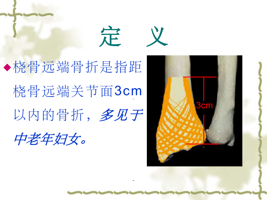 桡骨远端骨折护理查房课件-2.ppt_第3页