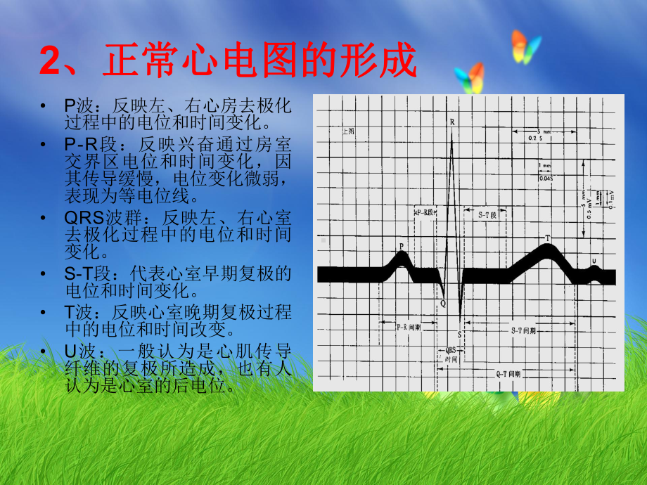 正常心电图及心律失常心电图的判读课件.ppt_第3页