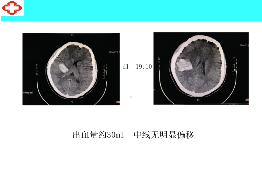 颅脑疾病的镇静镇痛课件.ppt_第3页