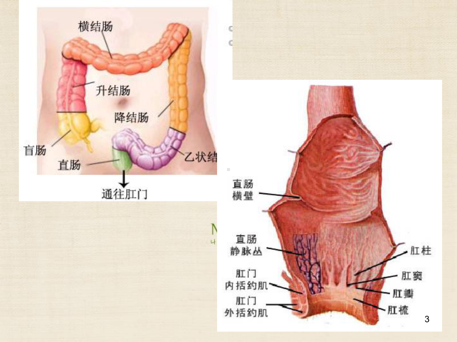 直肠癌手术护理课件.ppt_第3页