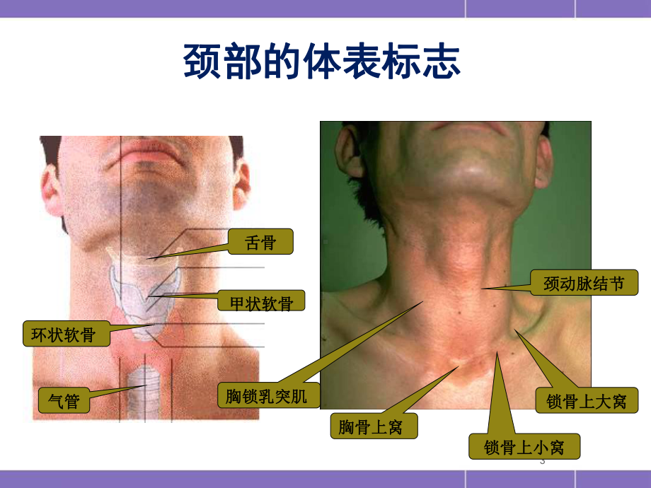 气管切开术课件.ppt_第3页