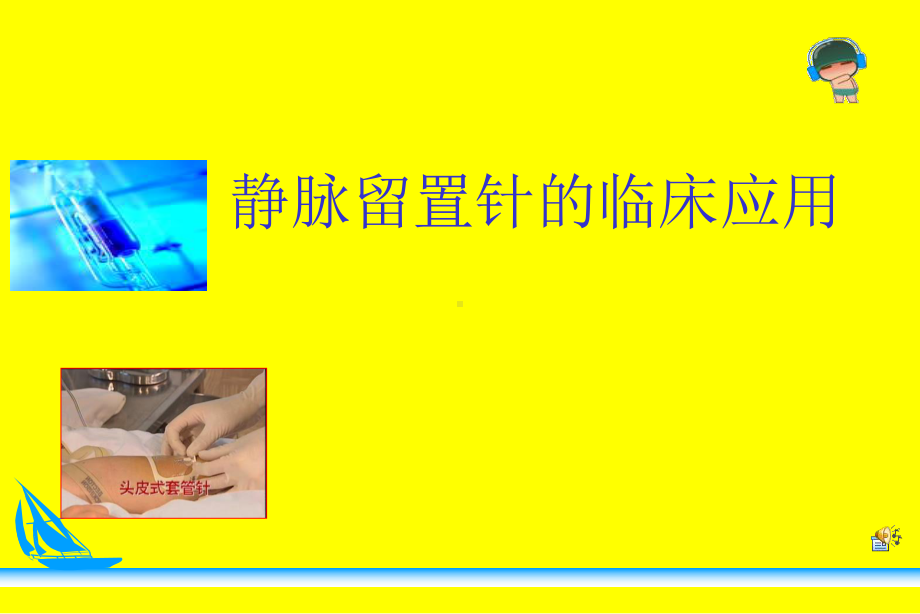 静脉留置针的穿刺技术及护理课件.ppt_第1页