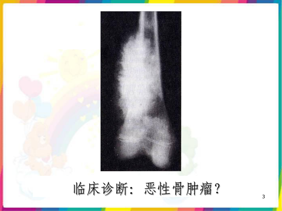 肿瘤的临床诊断课件.ppt_第3页